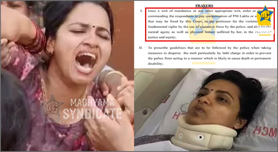 ‘പ്രതി ആലപ്പുഴ ഡിവൈഎസ്പി’; യൂത്ത് കോണ്‍ഗ്രസ് പ്രതിഷേധത്തിനിടെ ഗുരുതര പരുക്കേറ്റ മേഘയുടെ വെളിപ്പെടുത്തല്‍; നഷ്ടപരിഹാരം ആവശ്യപ്പെട്ടത് 50 ലക്ഷം