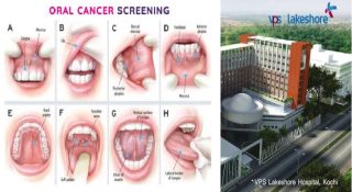ഓറൽ ക്യാൻസറിൽ ഞെട്ടിക്കുന്ന കണക്കുമായി ലേക്ഷോർ; പകുതിയിലേറെയും കാരണം കണ്ടെത്താനാകാത്ത കേസുകൾ